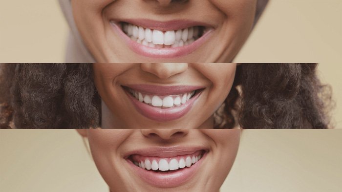 Thumbnail: Vídeo Institucional para Clínica Odontológica da 4D Odontologia – O Sorriso como Transformação | Lampejo Filmes